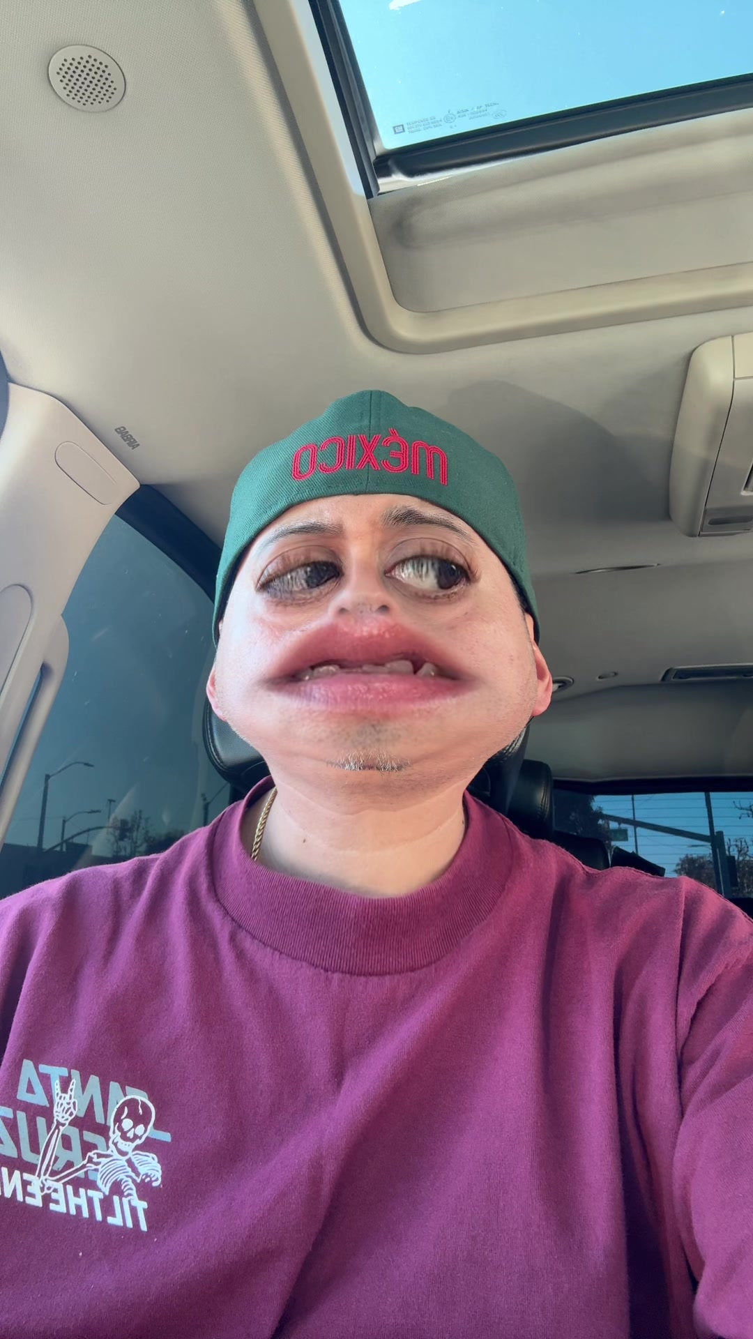 @MP