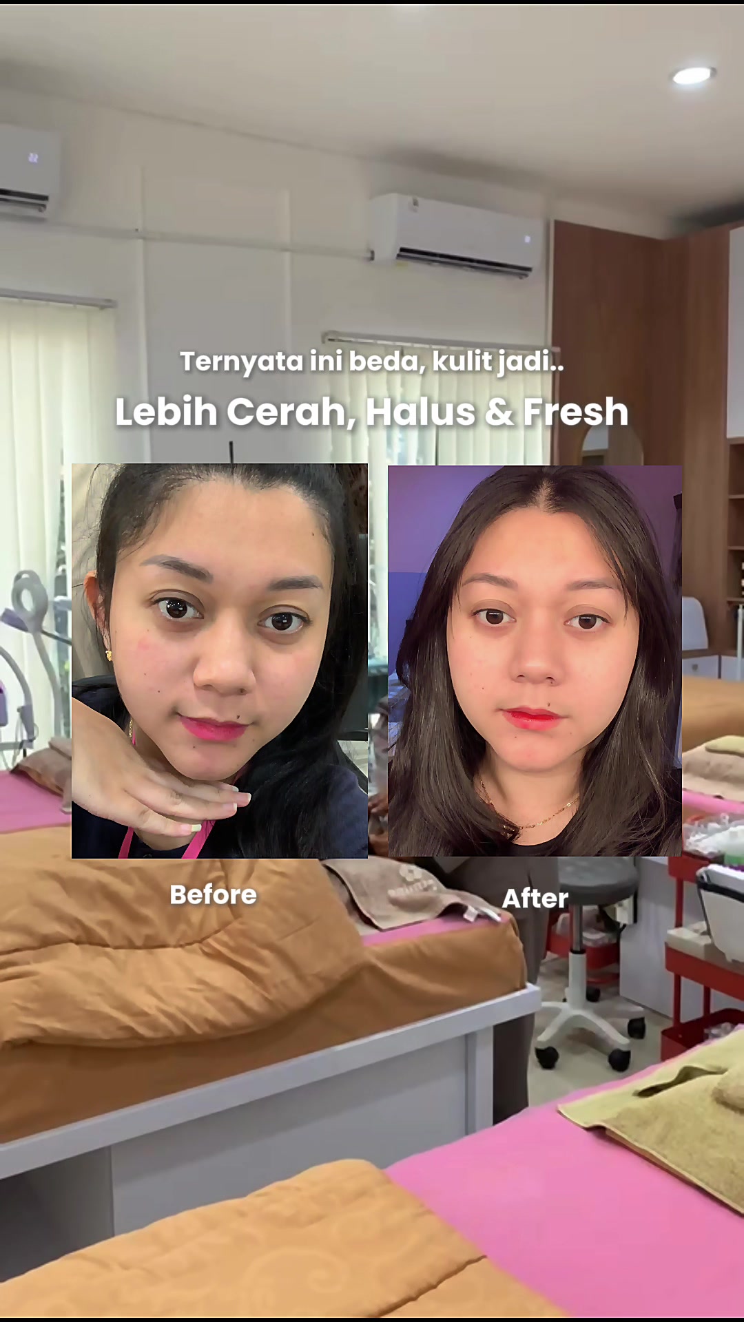 @Justmine Beauty Clinic Jakarta