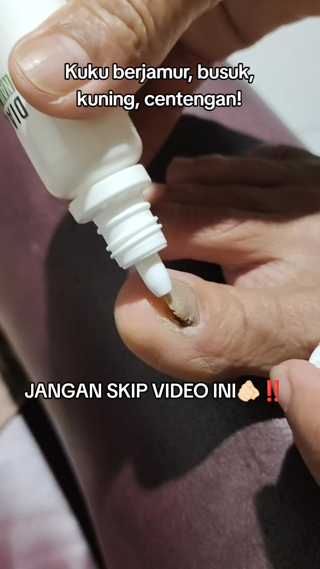 @starlees🕊️