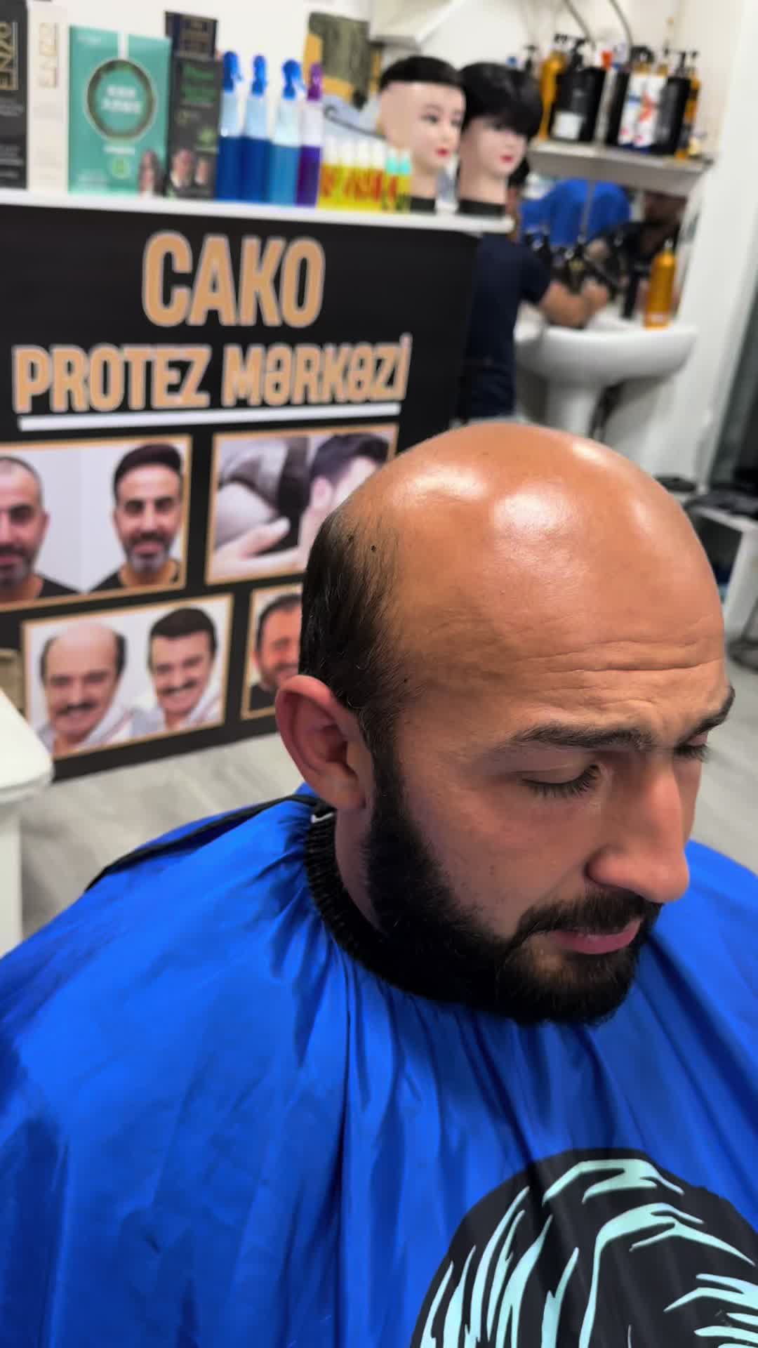 @cako ənucuz protez mərkəzi N:1