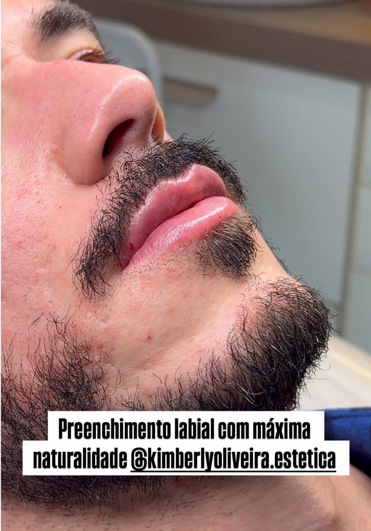 @Mateus Bandeira
