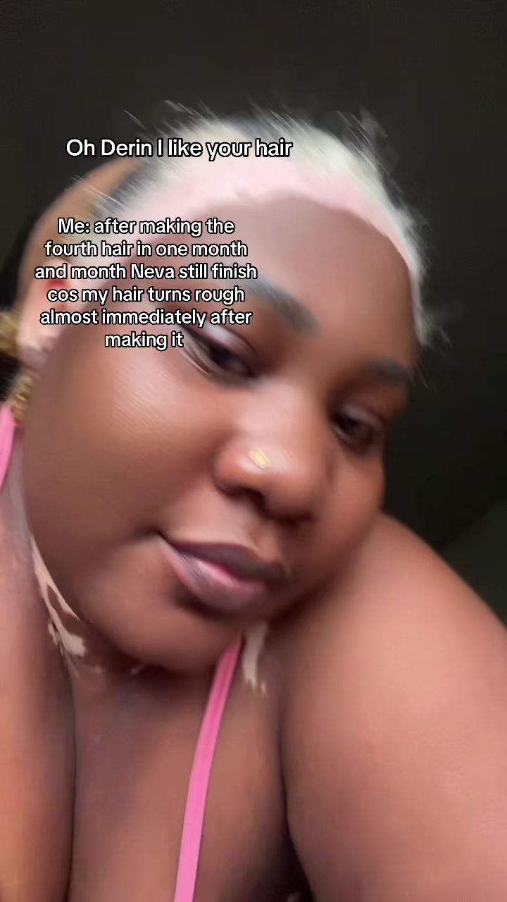 @Thevitiligogirl