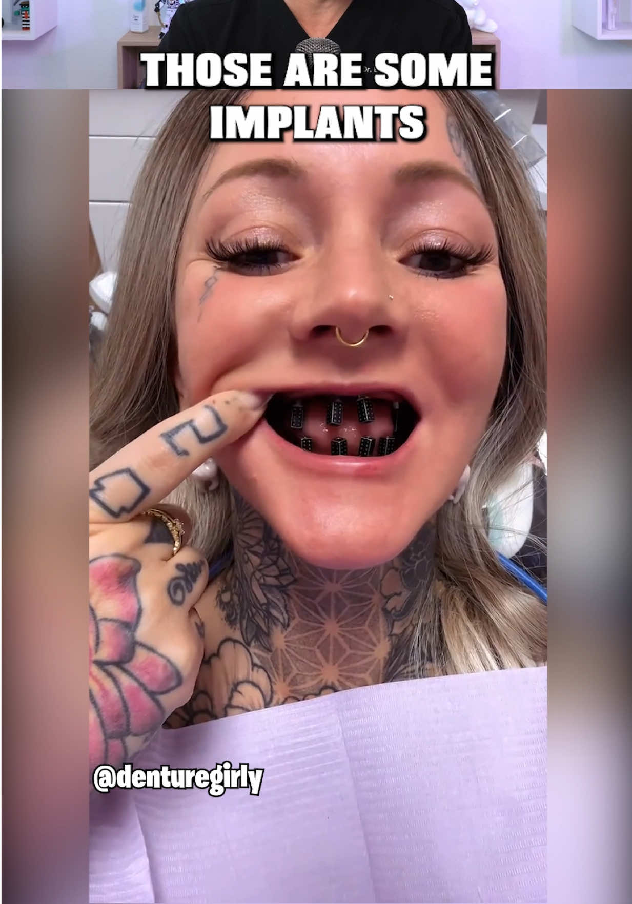 @Thebentist