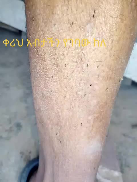 @miftahu zeyinu