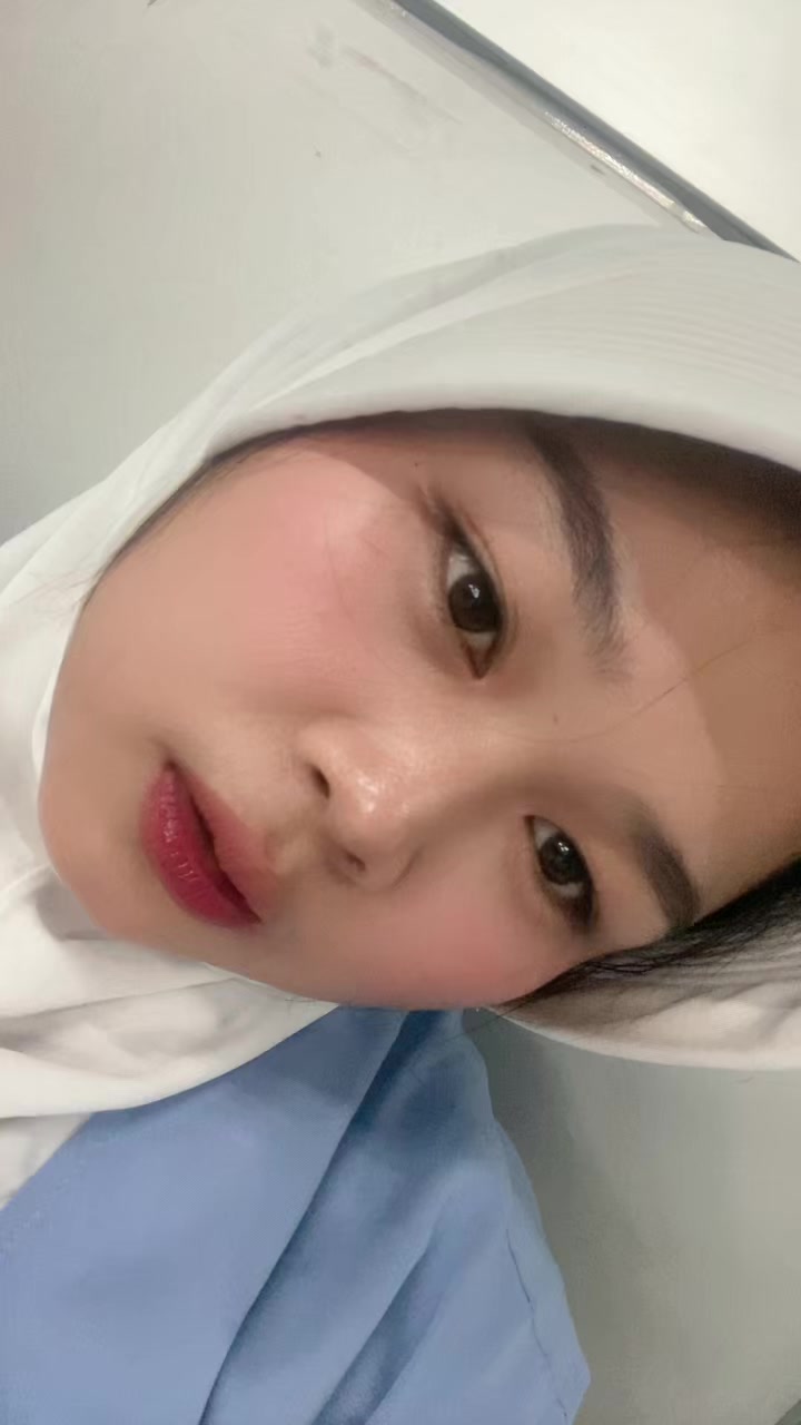 @mimoOom