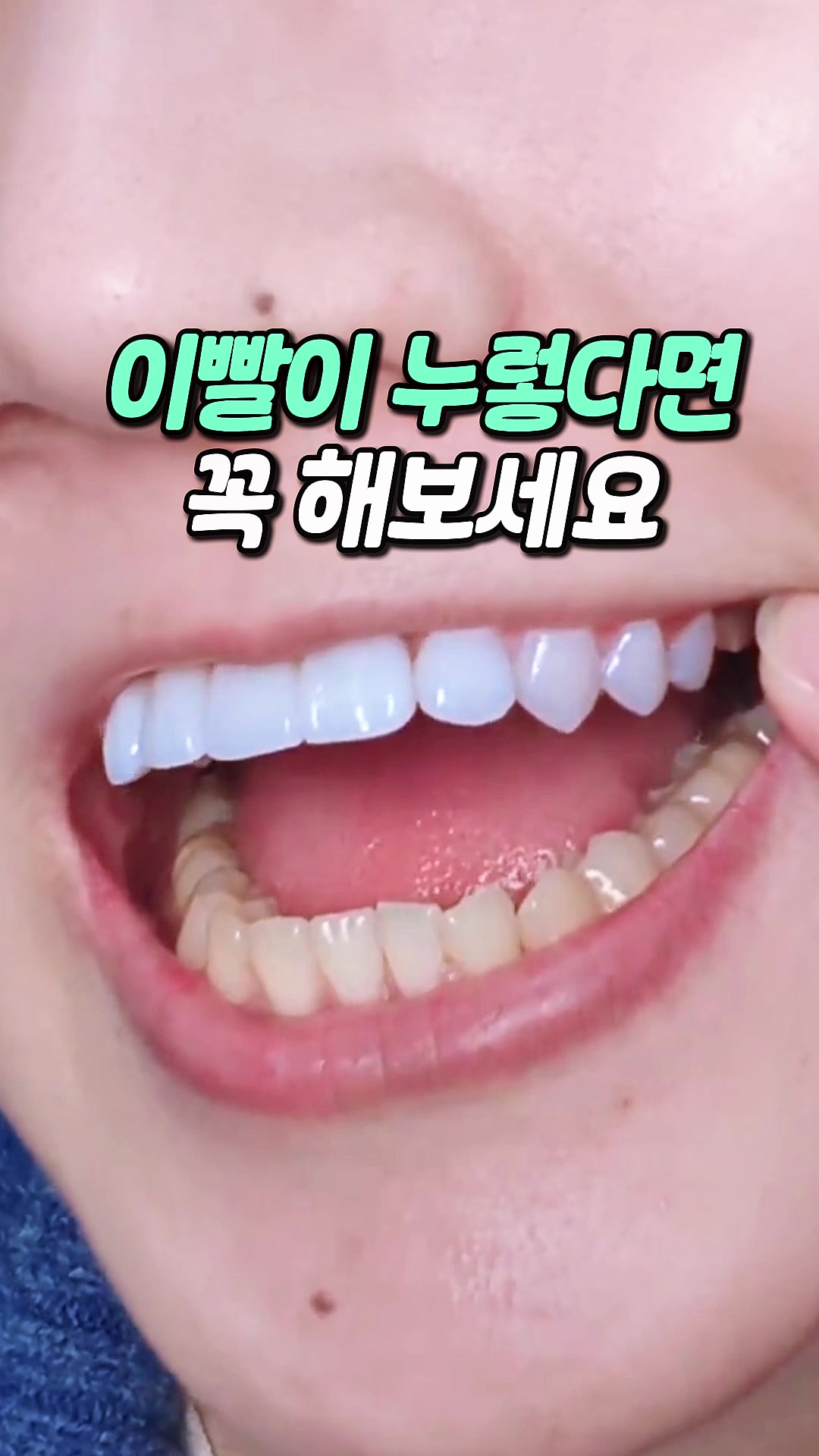 @멜로우픽