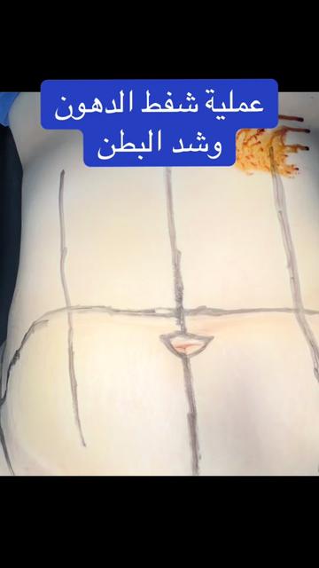 @Dr Hesham Wageh