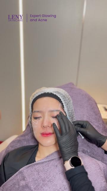 @Leny Skincare Karawaci