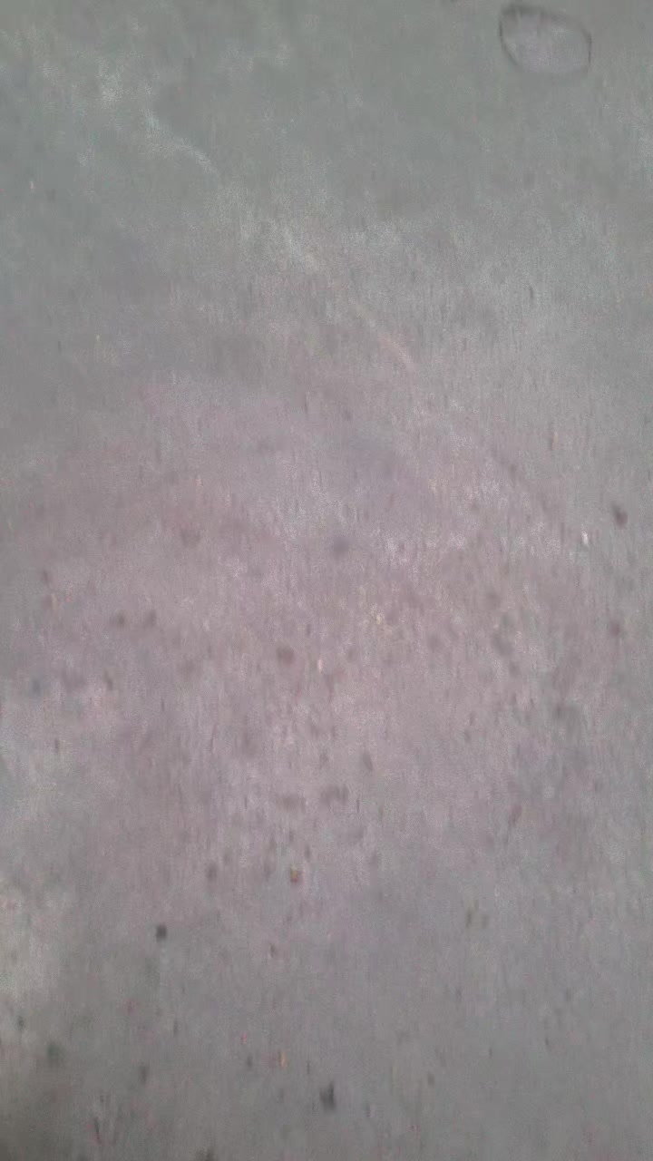 @NA. B. Bu