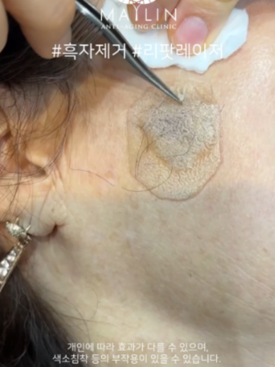 @메이린의원대구점