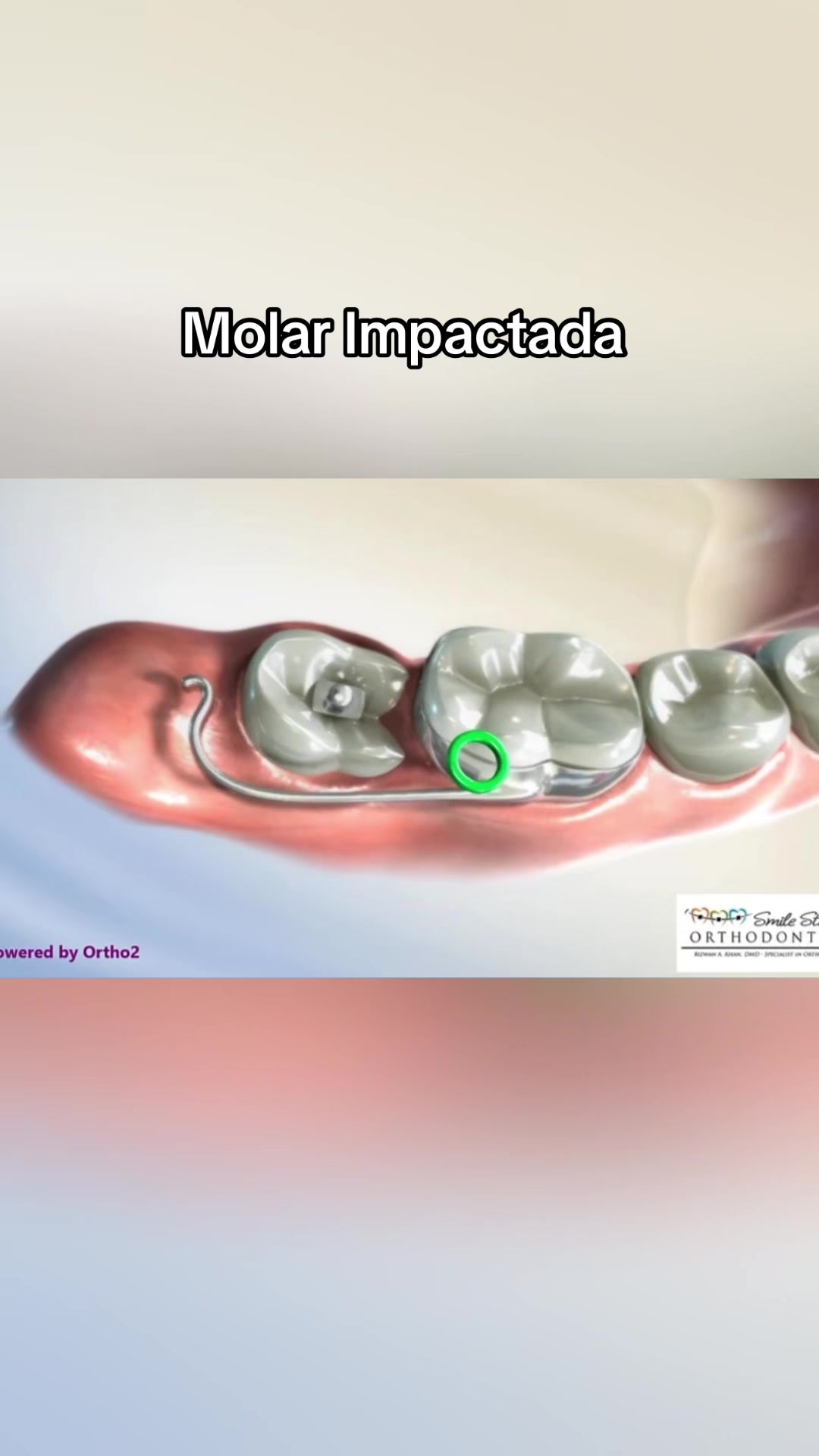 @DentikaBrackets