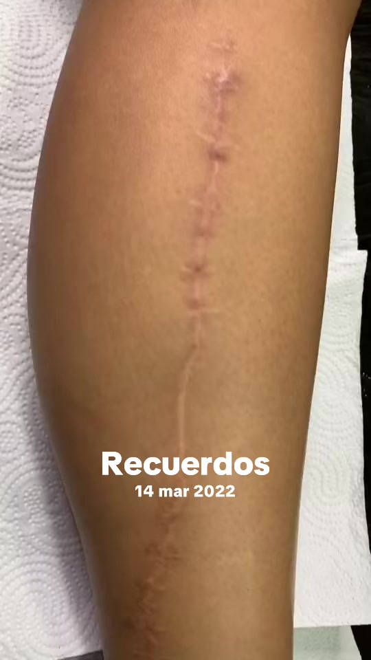 @Mauro Scorpions