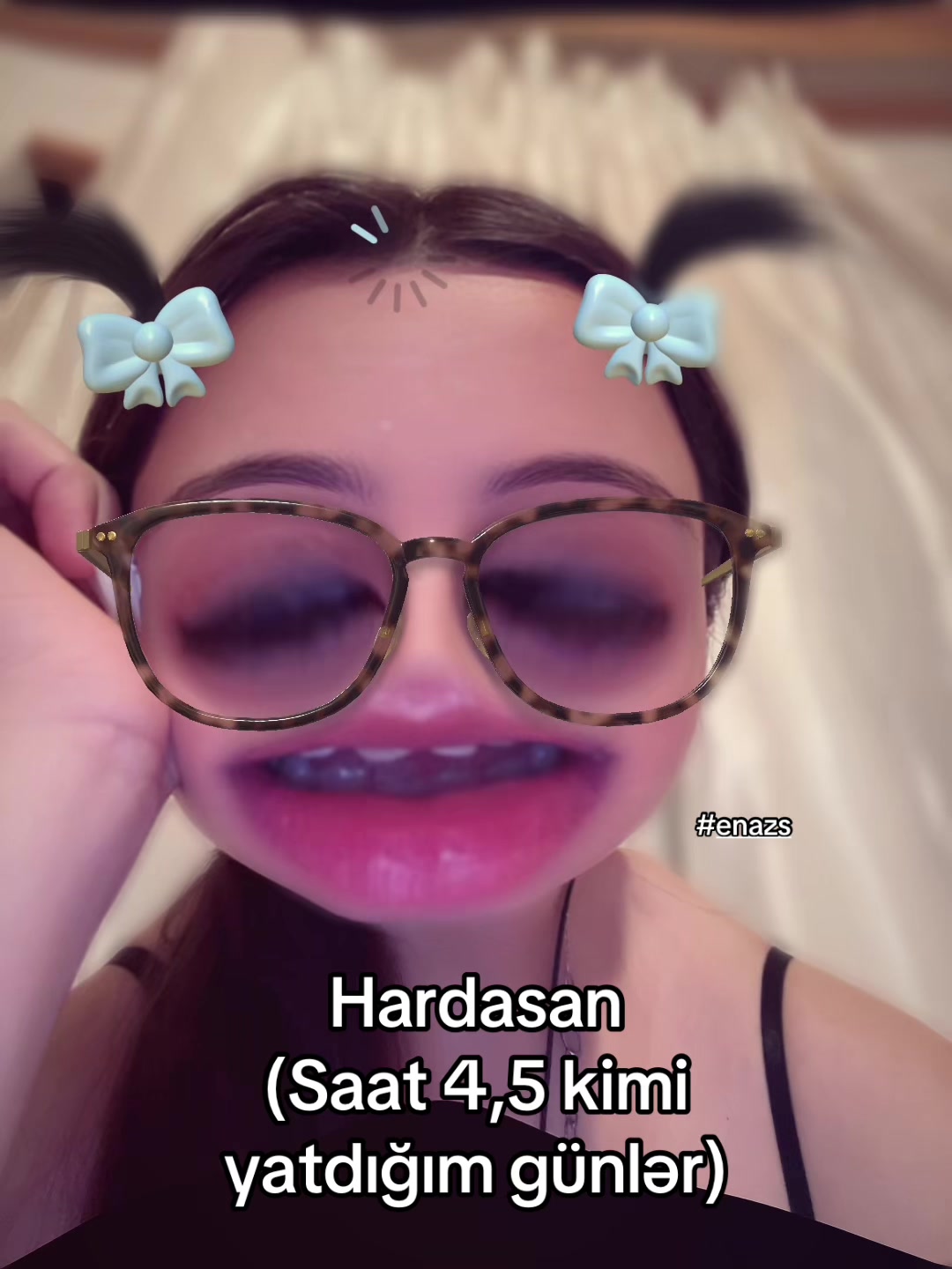 @๐๐ป๐ฎ๐๐