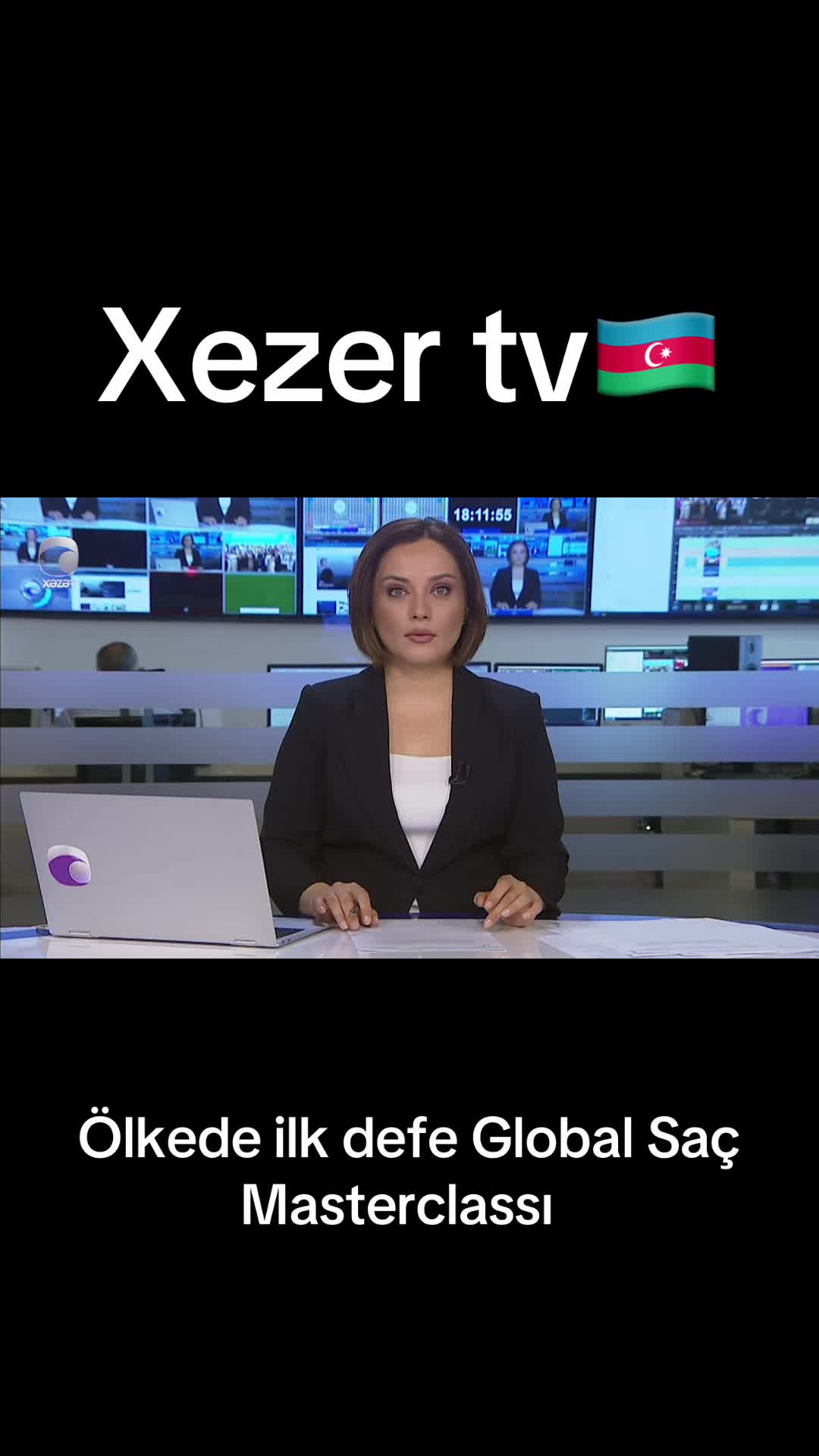 @Elbey Agayev