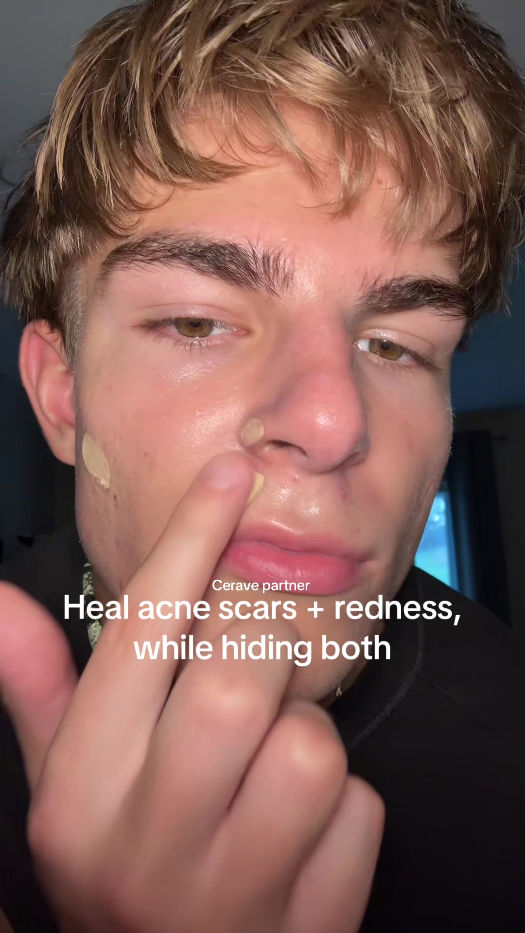 @Finn