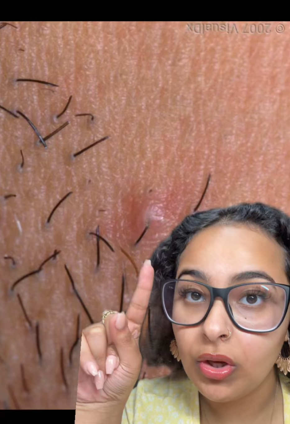 @Hadeel Aesthetics