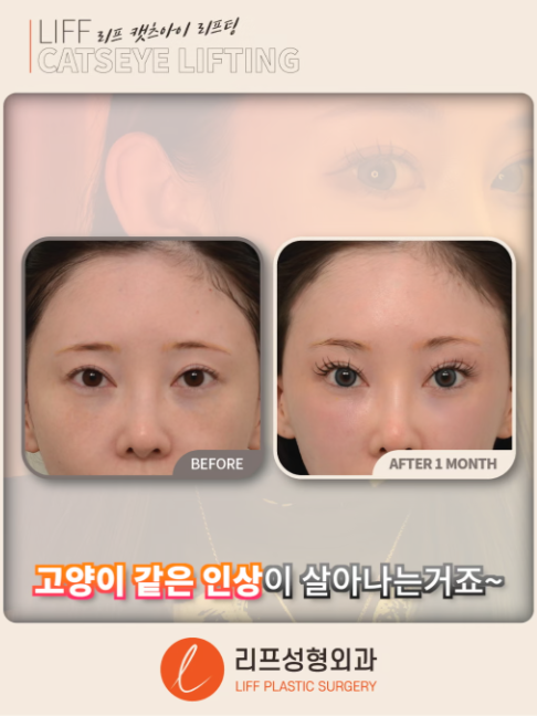@리프성형외과 김기엽 대표원장
