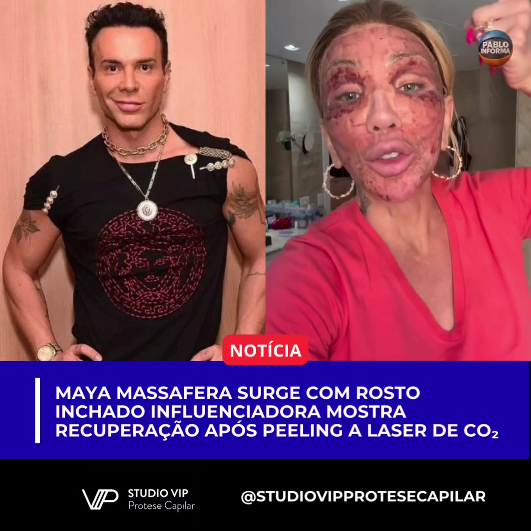 @Pablo Informa