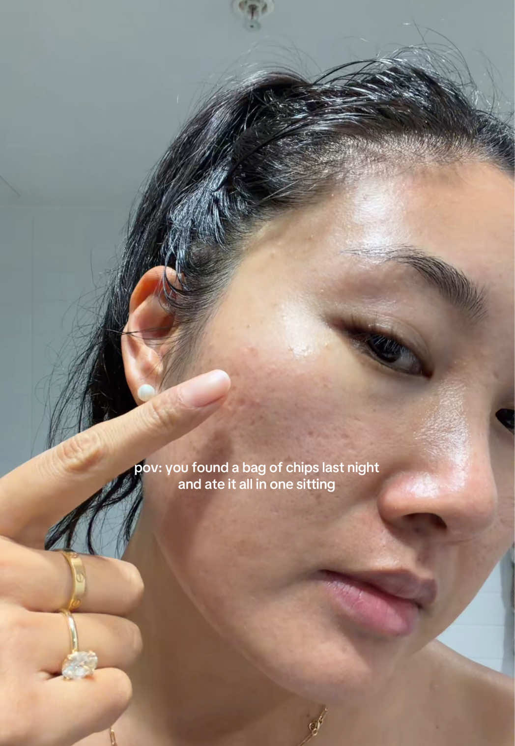 @Lisa | acne &rarr; clear skin