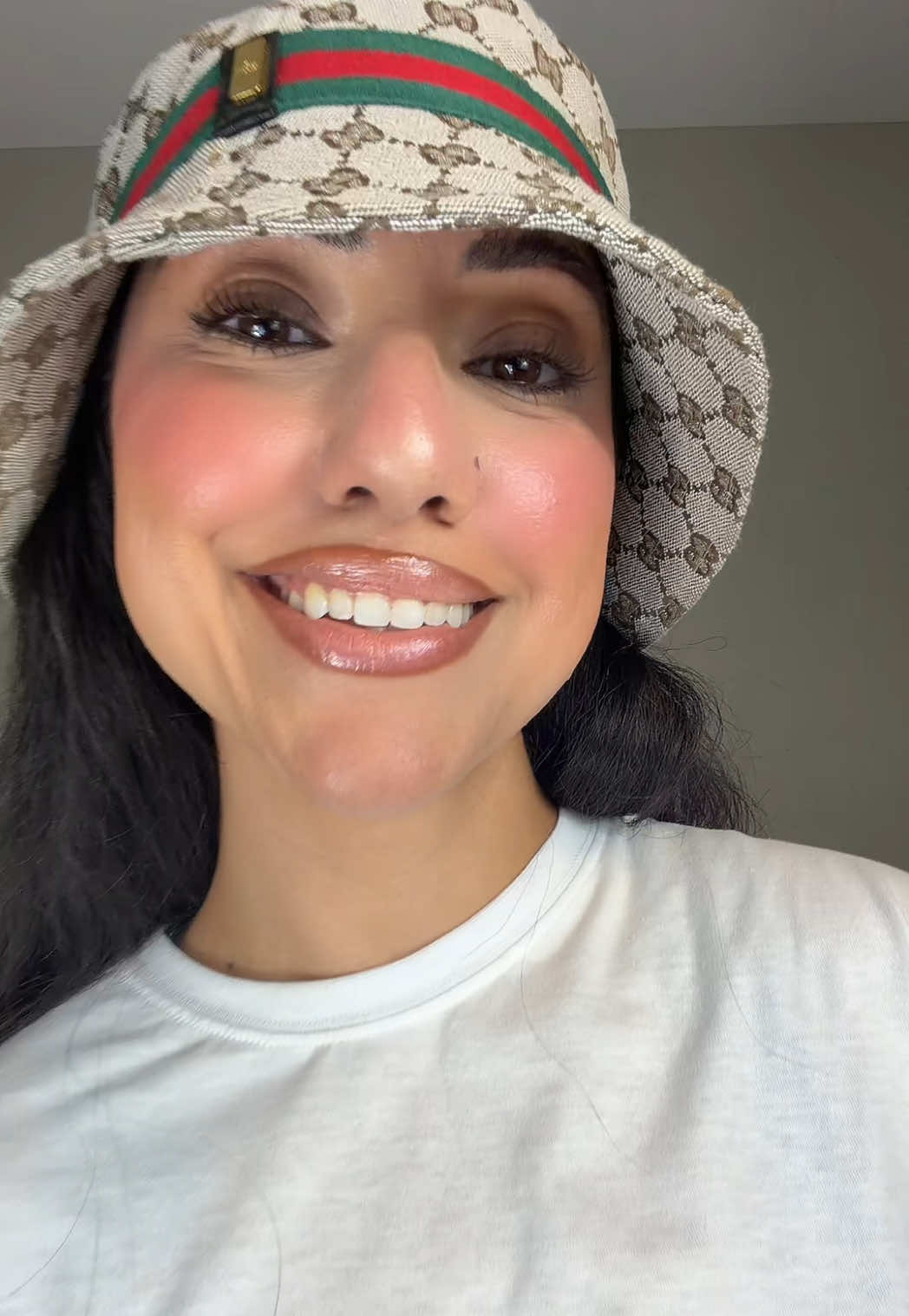 @๐๐ด๐
๐ด๐ป