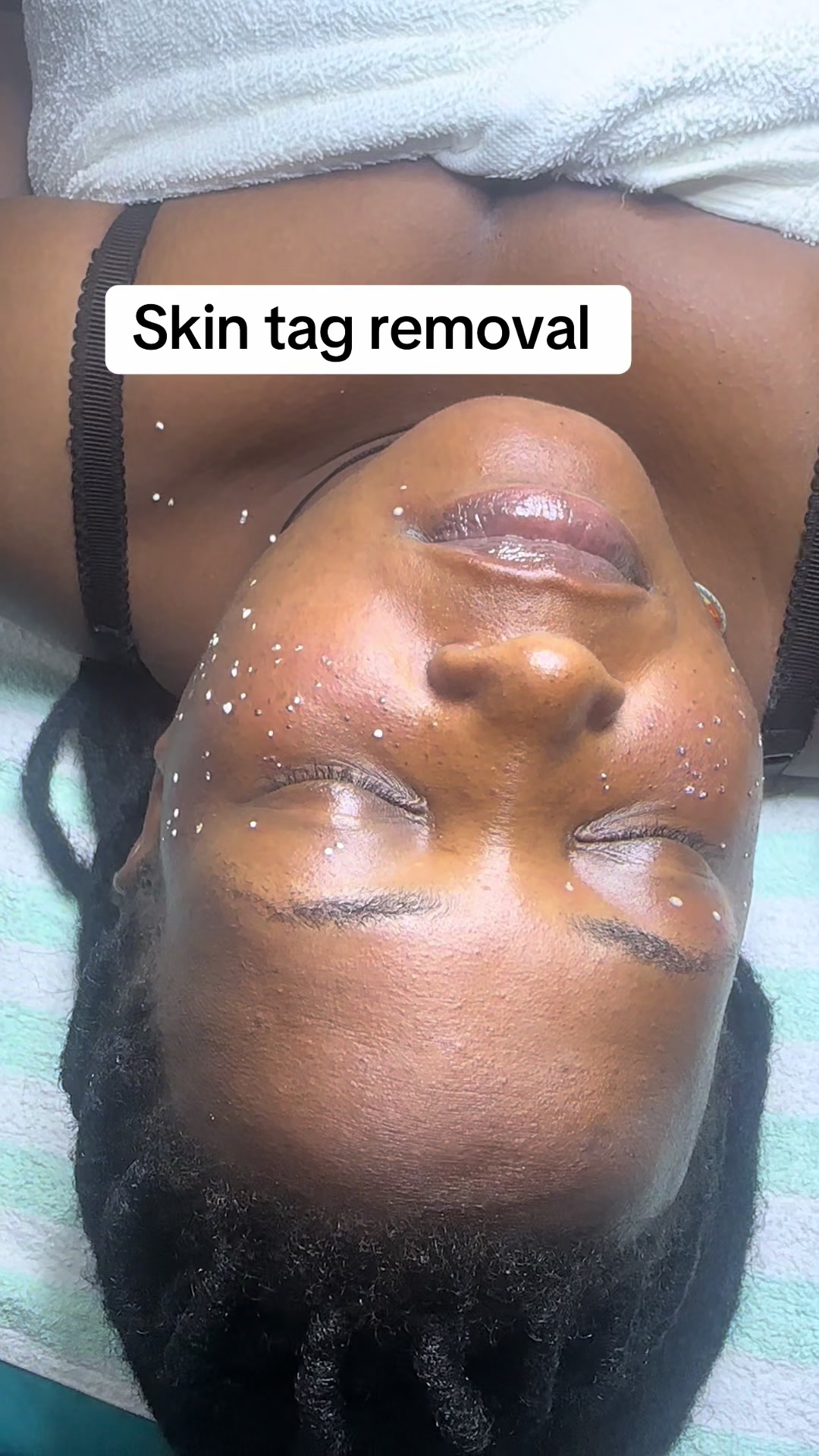 @CASIE SKINCARE & AESTHETIC SPA