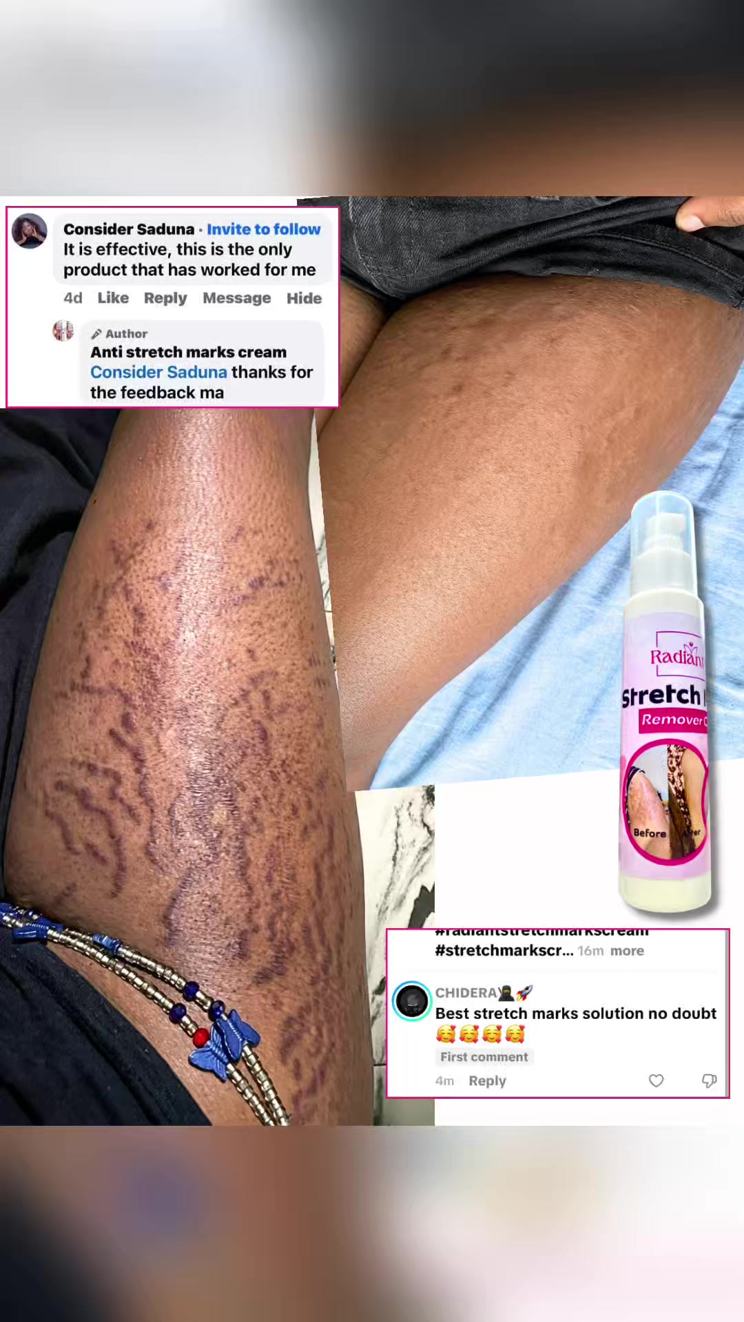 @Radiant skin