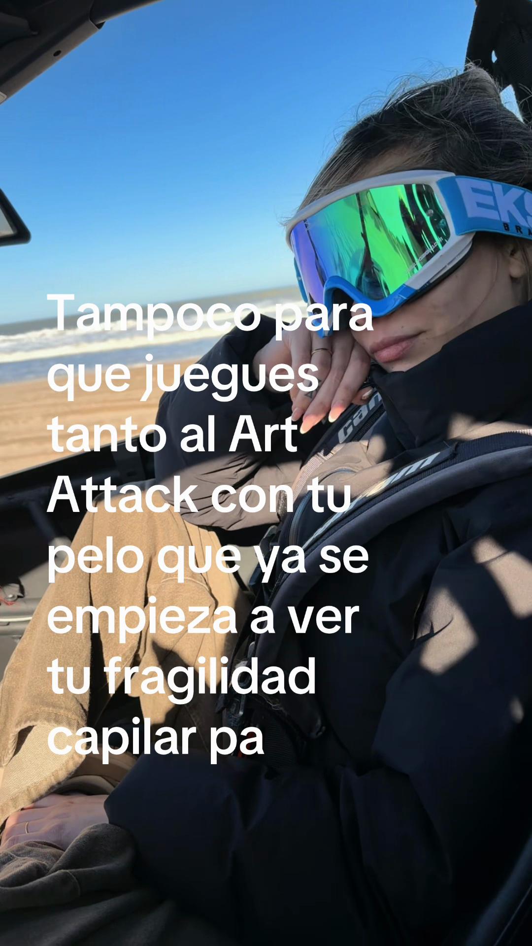 @Anto Teves