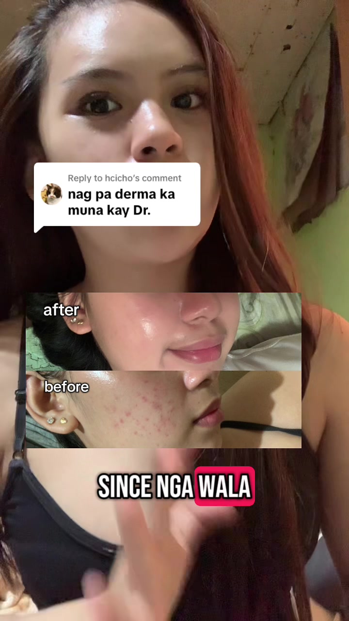 @grasyaa