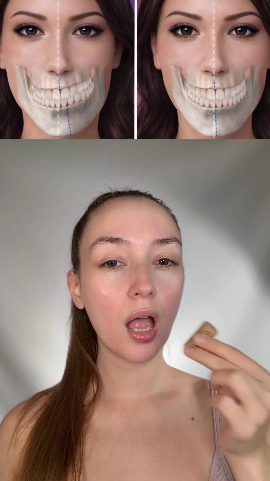 @Фейсбилдинг | Максилла