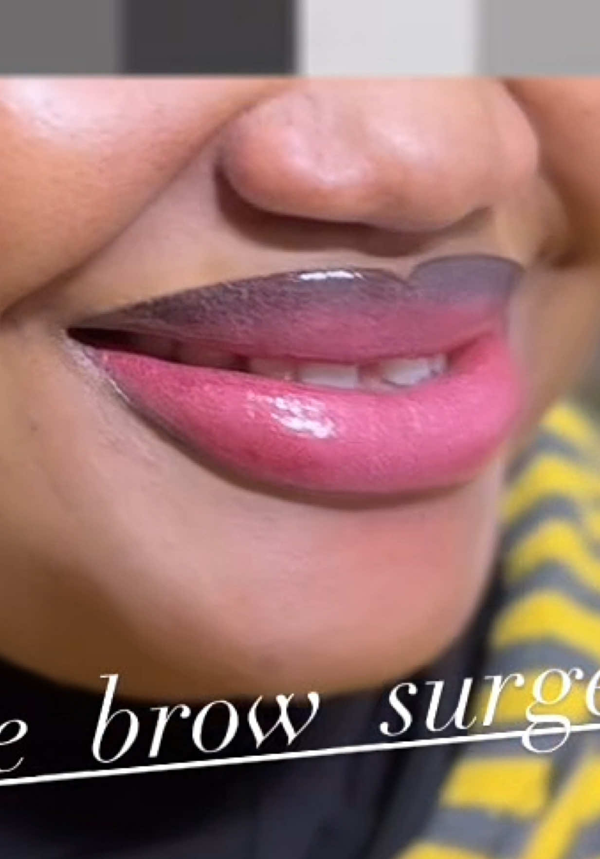 @the_brow_surgeon