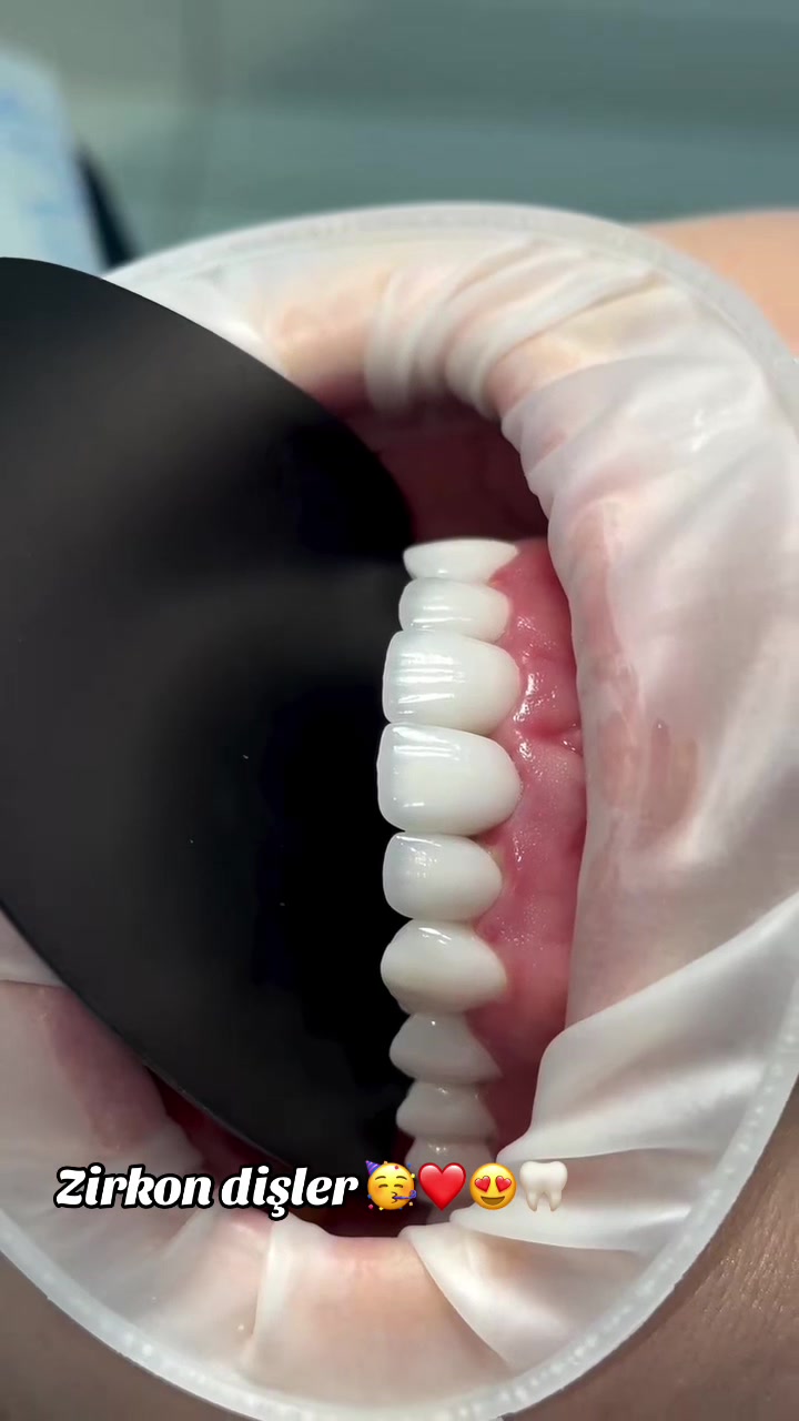 @𝐁𝐚𝐲𝐃𝐞𝐧𝐭𝐄𝐥𝐢𝐭𝐞🦷