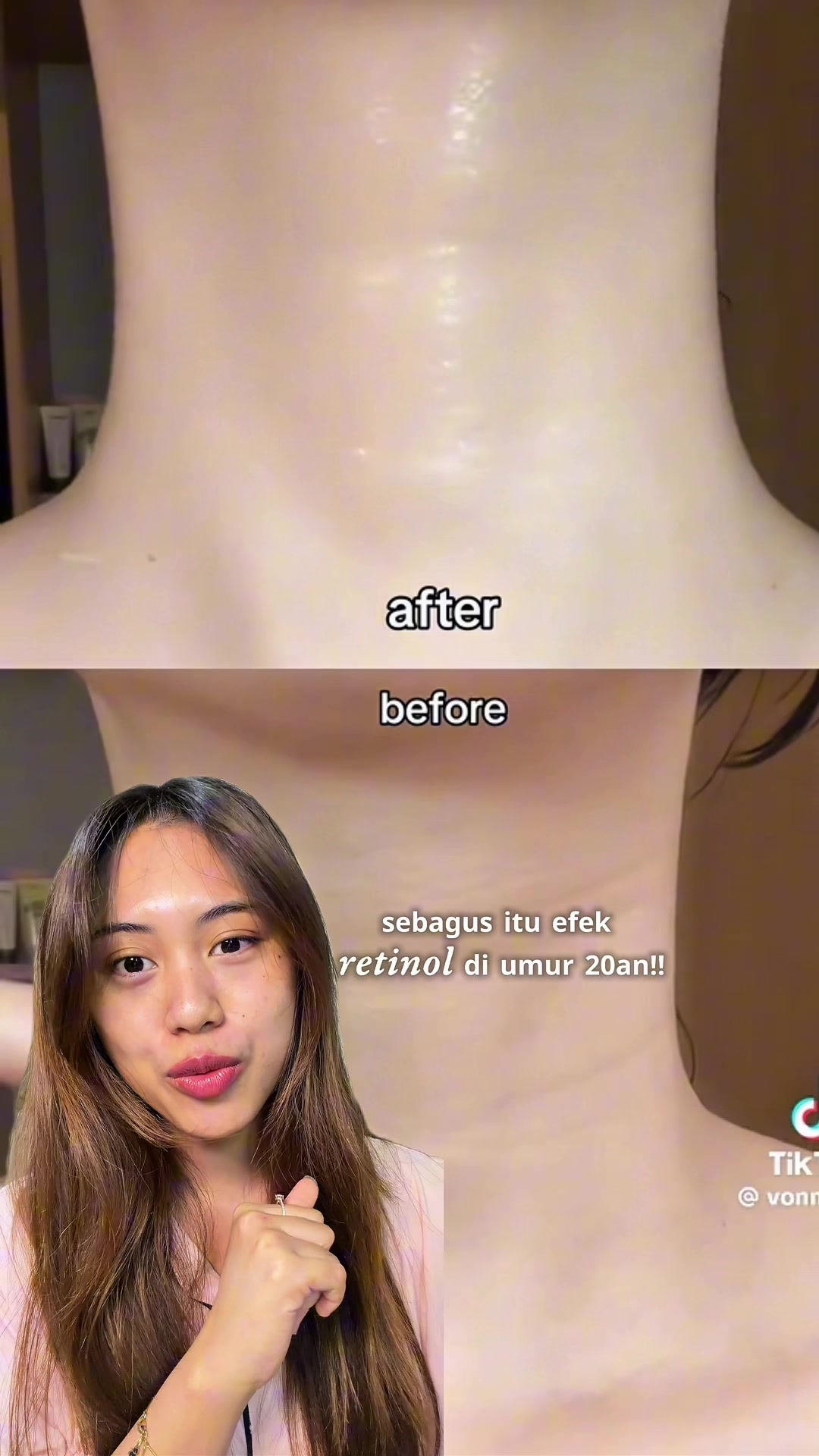 @dindapradnya