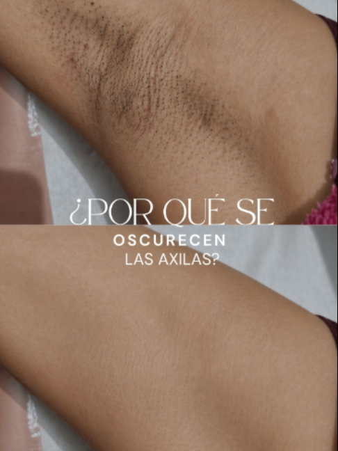 @M&aacute;sDepyl
