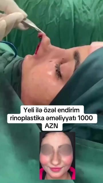 @Estetik_cerrah