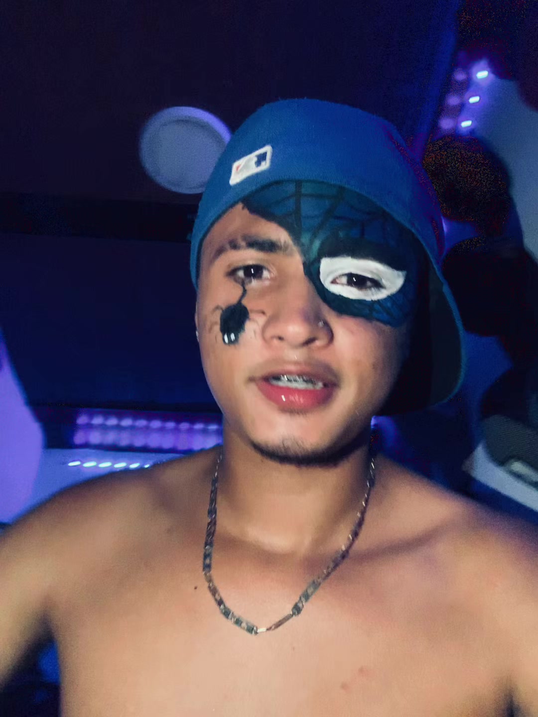 @Felipe Acosta🐺.