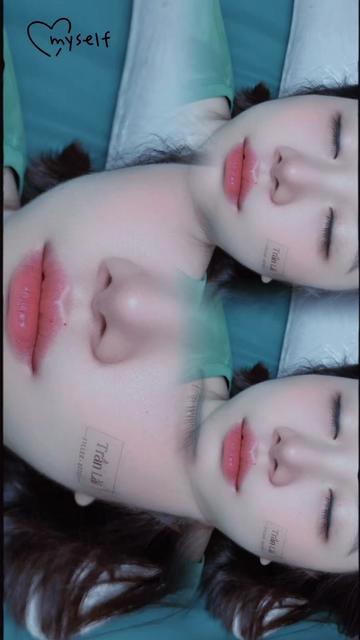 @Trần Lài 98