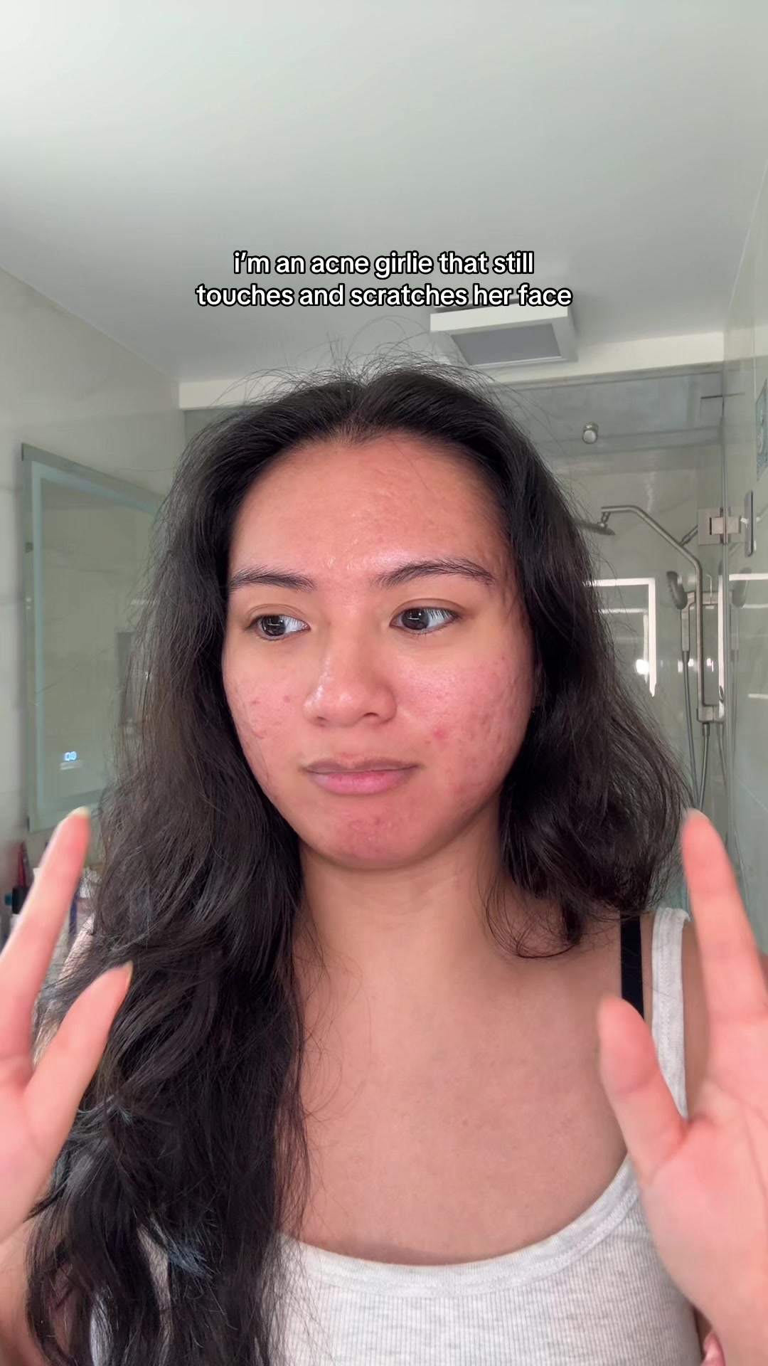 @jennilee • thatacnegirlie