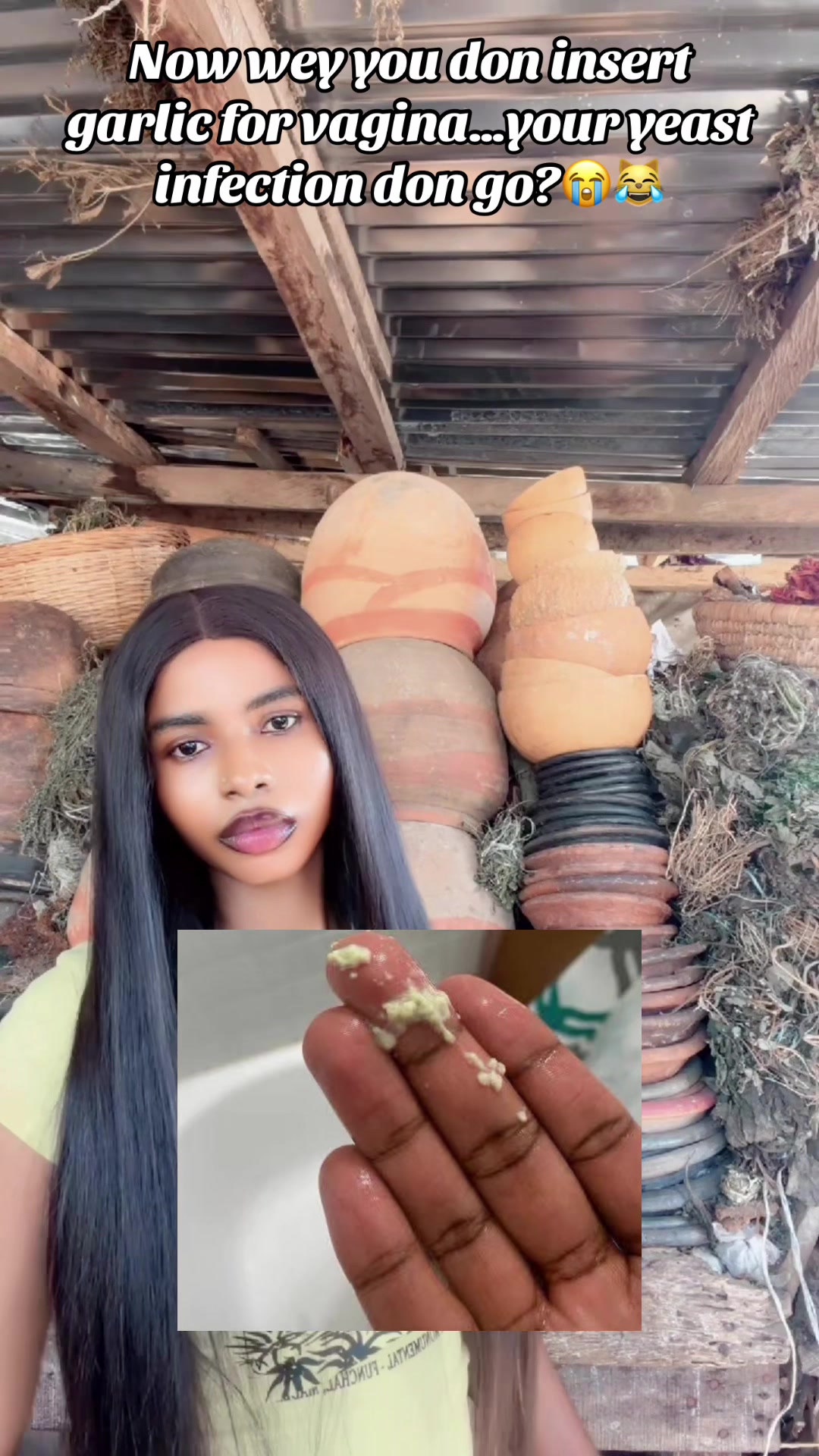 @GeNz_alagbo🐍🍯