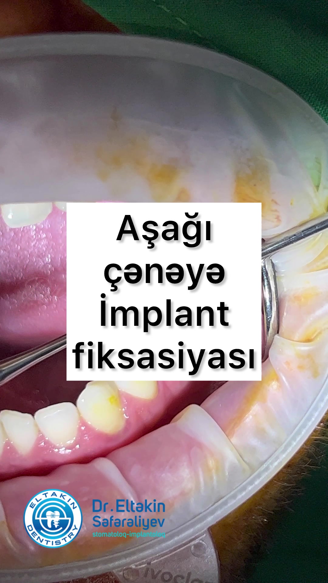 @eltakindentistry