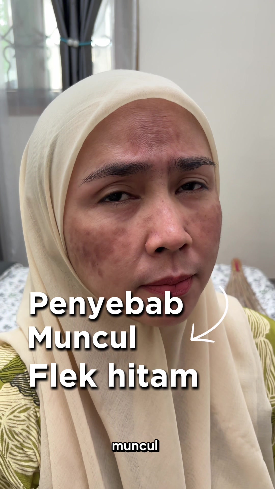 @AmuraOfficial