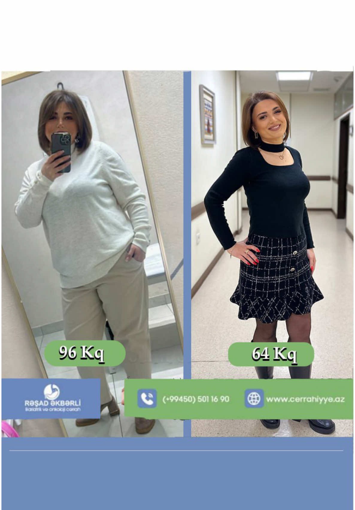 @&Uuml;mumi Cərrah Rəşad Əkbərli