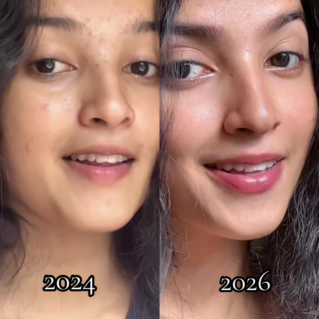 @Miyondi|මියොන්දි|மியொன்தி 🍷