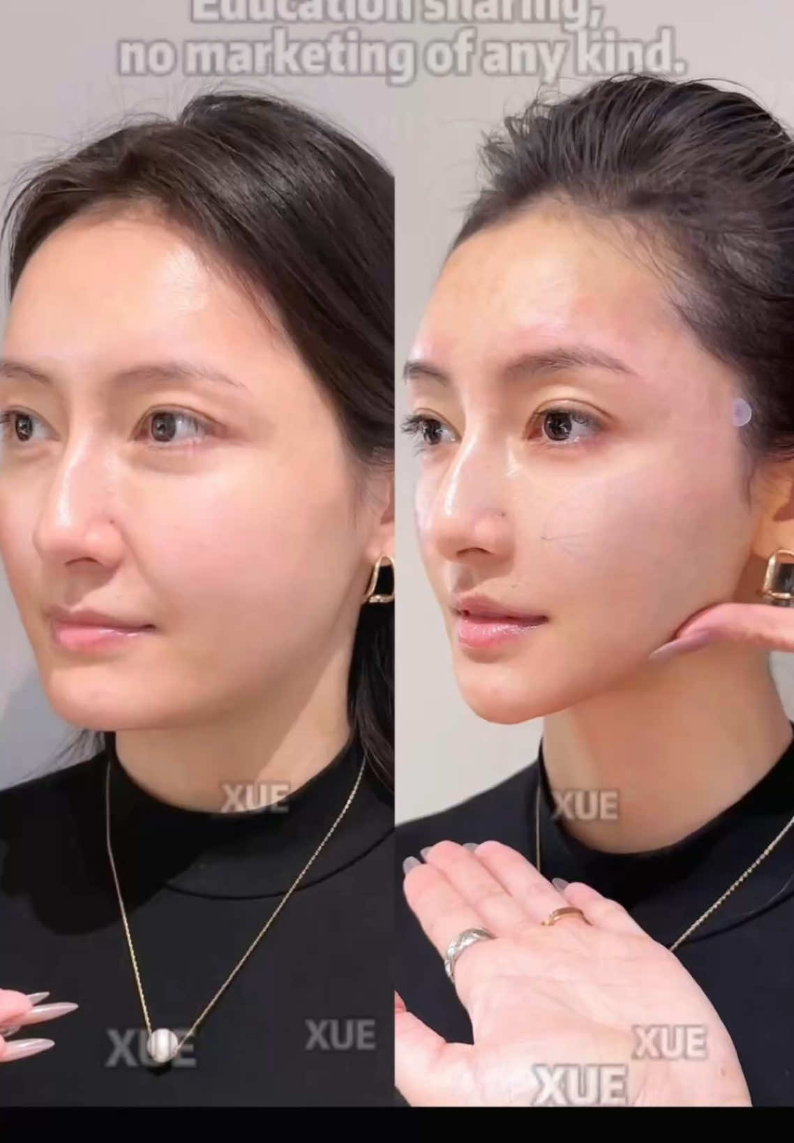@Xue Skin & Contour