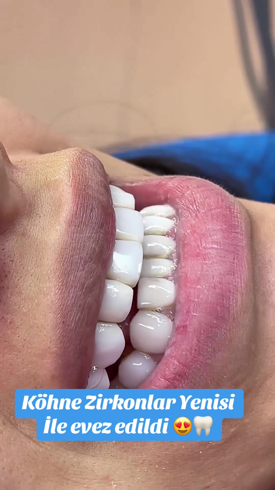 @𝐁𝐚𝐲𝐃𝐞𝐧𝐭𝐄𝐥𝐢𝐭𝐞🦷