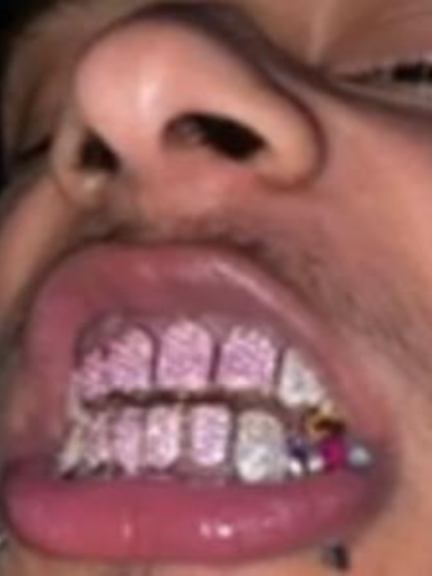 @*