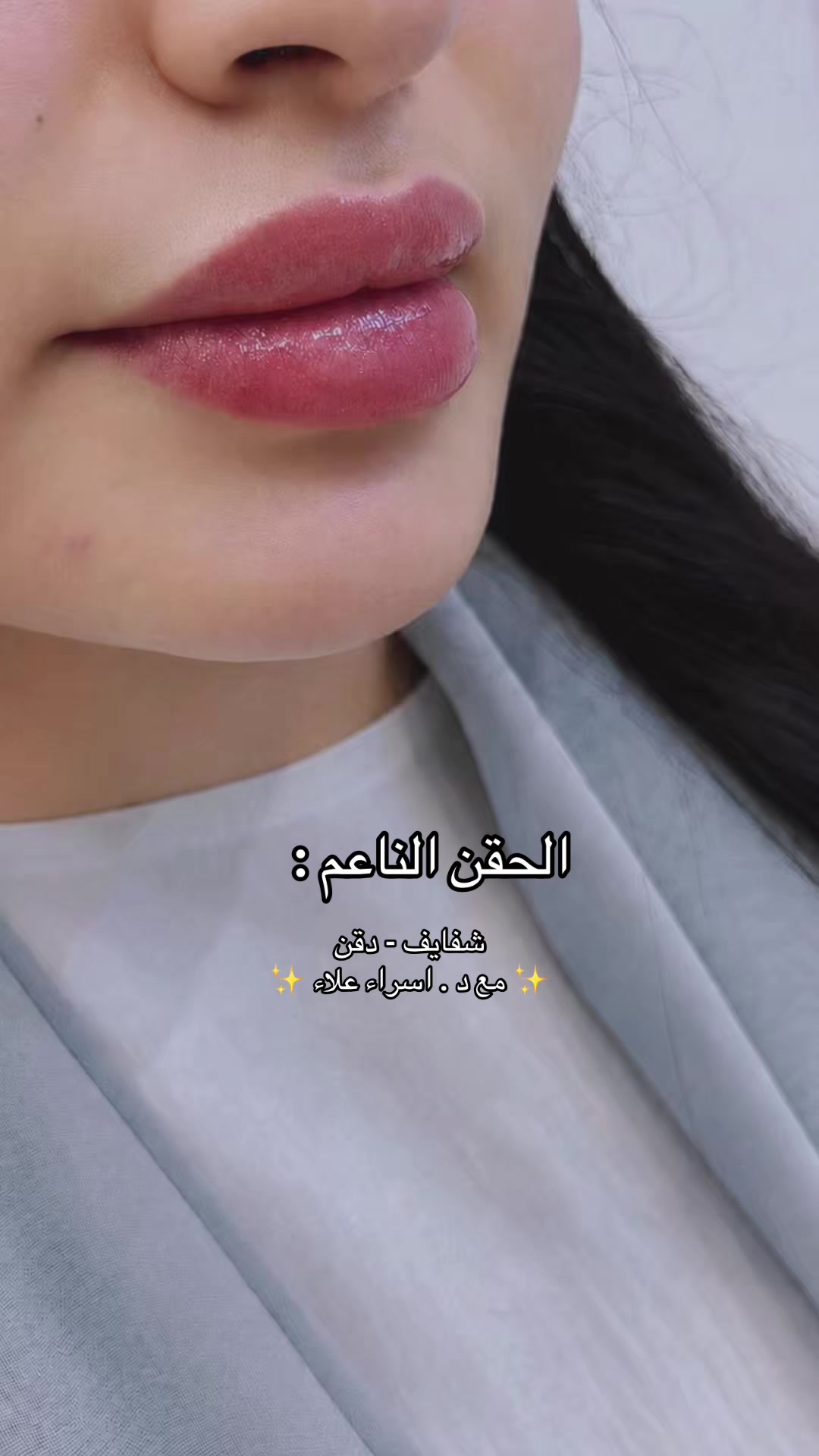 @مراس فرع النزهة