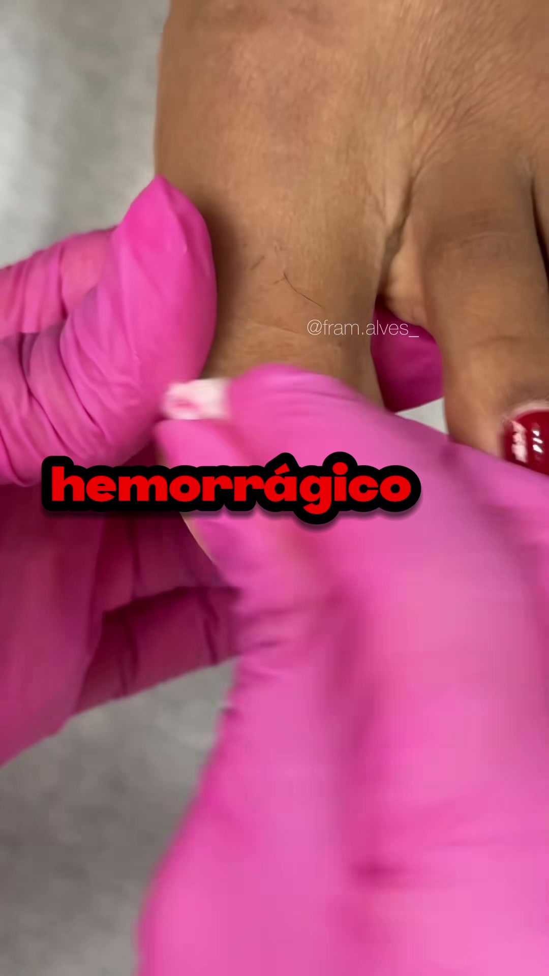 @Barthours