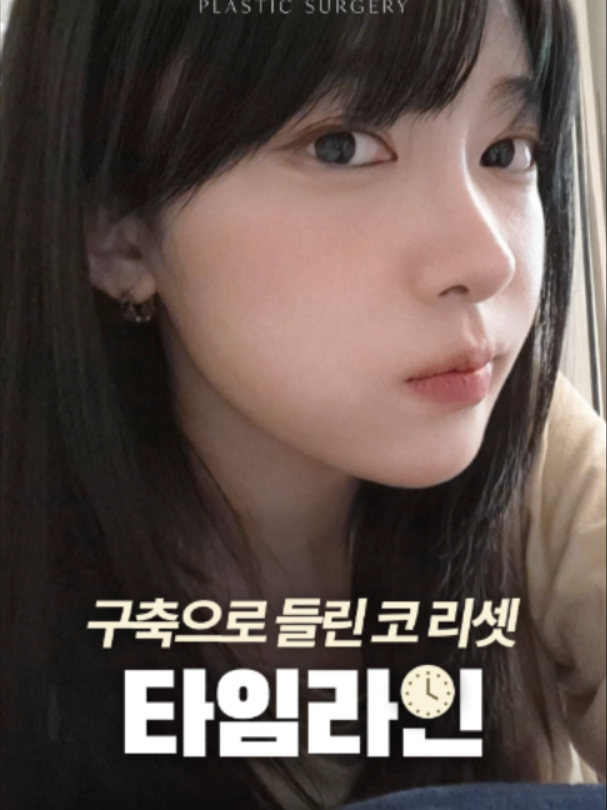 @리셋성형외과