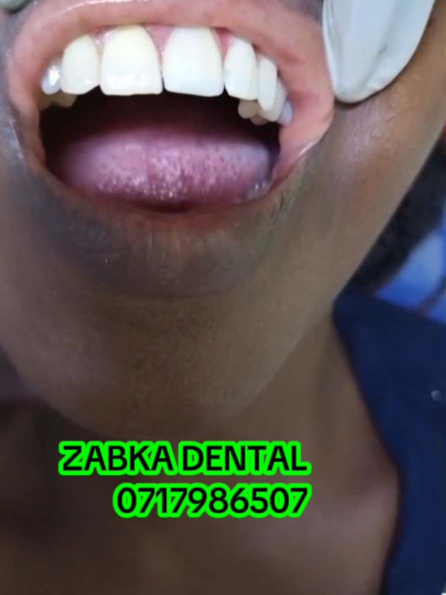 @Zabka Dental