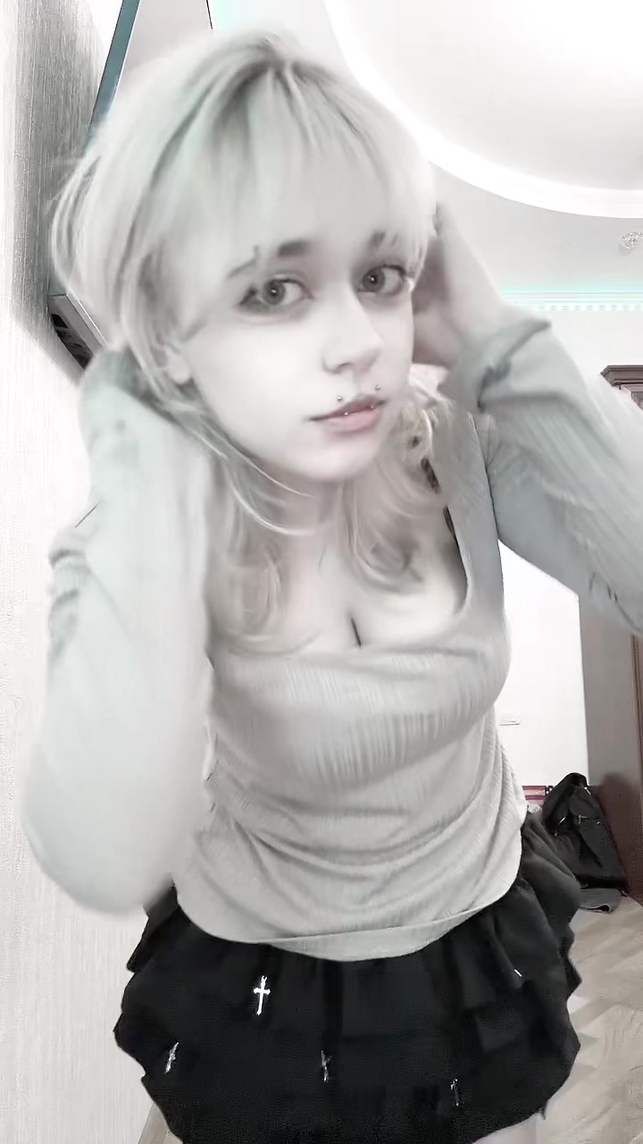 @uglyrosis